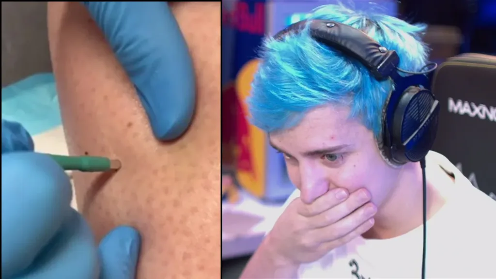 Ninja diagnosed with melanoma