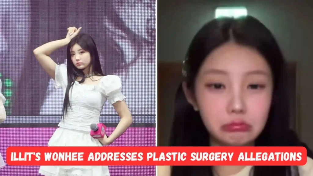 lee-wonhee-plastic-surgery